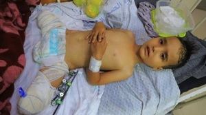 El pequeño invalido de Gaza